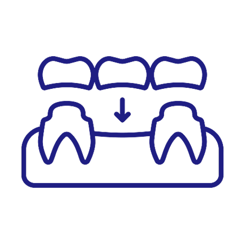 Cosmetic Dentistry Miami, Miami Teeth Whitening, Dental Veneers Miami FL, Best Cosmetic Dentist Miami, True Dentistry Plus Services, Dental Implants Miami, Permanent Tooth Replacement Miami, True Dentistry Plus Dental Implants, Best Implant Dentist in Miami, Miami Dental Implant Services, Dentures Miami, Custom Dentures Miami FL, Full Dentures Miami, Partial Dentures Miami, True Dentistry Plus Dentures, Gum Contouring Miami, Miami Gum Reshaping, Cosmetic Gum Surgery Miami FL, True Dentistry Plus Gum Contouring, Smile Enhancement Miami, Porcelain Crowns Miami, Durable Dental Crowns Miami FL, True Dentistry Plus Crowns, Cosmetic Dental Crowns Miami, Natural-Looking Crowns Miami, Smile Makeover Miami, True Dentistry Plus Smile Enhancement, Miami Smile Design, Full Smile Restoration Miami, Professional Teeth Bleaching Miami, True Dentistry Plus Whitening Services, Miami Cosmetic Teeth Whitening, Best Teeth Whitening Miami FL, Porcelain Veneers Miami FL, True Dentistry Plus Veneers, Cosmetic Veneers Miami, Best Veneers Dentist in Miami, Emergency Dentist Miami, 24/7 Dental Care Miami FL, Urgent Dental Care Miami, True Dentistry Plus Emergency Services, Miami Emergency Dental Services, Miami Dentist, Dental Care Miami FL, Family Dentistry Miami, Dental Health Blog Miami, True Dentistry Plus Blog, Miami Dental Care Tips, Dental News Miami FL, Oral Health Insights Miami, Contact True Dentistry Plus, Miami Dentist Contact, Schedule Dental Appointment Miami, Dental Office Location Miami, True Dentistry Plus Phone Number, Dental Deals Miami, True Dentistry Plus Specials, Miami Dental Offers, Teeth Whitening Discounts Miami, Invisalign Promotion Miami, Oral Surgery Miami, Wisdom Tooth Extraction Miami FL, True Dentistry Plus Oral Surgeons, Miami Oral Surgery Clinic, Tooth Extractions Miami, Bone Grafting Miami FL, Dental Surgery Miami, True Dentistry Plus Extractions, Miami Bone Graft Procedures, LANAP Miami, Laser Gum Therapy Miami FL, Minimally Invasive Gum Treatment Miami, True Dentistry Plus LANAP, Gum Disease Treatment Miami, Sinus Lift Surgery Miami, Dental Implant Preparation Miami, True Dentistry Plus Sinus Lift, Sinus Augmentation Miami, Wisdom Tooth Extractions Miami, Remove Wisdom Teeth Miami FL, Oral Surgery for Wisdom Teeth Miami, Miami Wisdom Teeth Removal, Orthodontics Miami, Braces Miami FL, Invisalign Miami, True Dentistry Plus Orthodontics, Teeth Straightening Miami, Clear Aligners Miami FL, True Dentistry Plus Invisalign, Invisalign Dentist Miami, Invisible Braces Miami, Preventive Dentistry Miami, Dental Cleanings Miami FL, Oral Exams Miami, True Dentistry Plus Preventive Care, Miami Dental Checkups, Comprehensive Dental Exams Miami, Full Oral Exam Miami FL, Dental Checkup Miami, True Dentistry Plus Exams, Dental Hygiene Miami, Teeth Cleaning Miami FL, Oral Hygiene Services Miami, True Dentistry Plus Dental Cleanings, Preventive Dental Care Miami, Nightguards Miami, Custom Mouthguards Miami FL, Teeth Grinding Protection Miami, Bruxism Treatment Miami, True Dentistry Plus Nightguards, Oral Cancer Screening Miami, Early Detection Oral Cancer Miami FL, Oral Health Screening Miami, True Dentistry Plus Screenings, Periodontics Miami, Deep Cleaning Dentist Miami, True Dentistry Plus Periodontics, Scaling and Root Planing Miami, Sleep Apnea Therapy Miami, Snoring Treatment Miami FL, Sleep Apnea Dentist Miami, Oral Appliance Therapy Miami, True Dentistry Plus Sleep Solutions, TMJ Treatment Miami, TMD Therapy Miami FL, Jaw Pain Relief Miami, True Dentistry Plus TMJ Specialist, TMJ Dentist Miami, Restorative Dentistry Miami, Dental Crowns and Bridges Miami FL, Tooth Repair Miami, True Dentistry Plus Restorations, Dental Bridges Miami, Replace Missing Teeth Miami FL, Tooth Bridge Miami, True Dentistry Plus Dental Bridges, Fixed Dental Bridge Miami, Dental Fillings Miami, Cavity Treatment Miami FL, Tooth Fillings Miami, Composite Fillings Miami, True Dentistry Plus Fillings, Smile Restoration Miami FL, Complete Dental Makeover Miami, True Dentistry Plus Reconstruction, Rebuild Smile Miami, Full-Arch Dental Implants Miami, All-on-4 Implants Miami FL, Full Mouth Implants Miami, True Dentistry Plus Implants, Root Canal Miami, Endodontic Treatment Miami FL, Tooth Pain Relief Miami, True Dentistry Plus Root Canal, Save Infected Tooth Miami