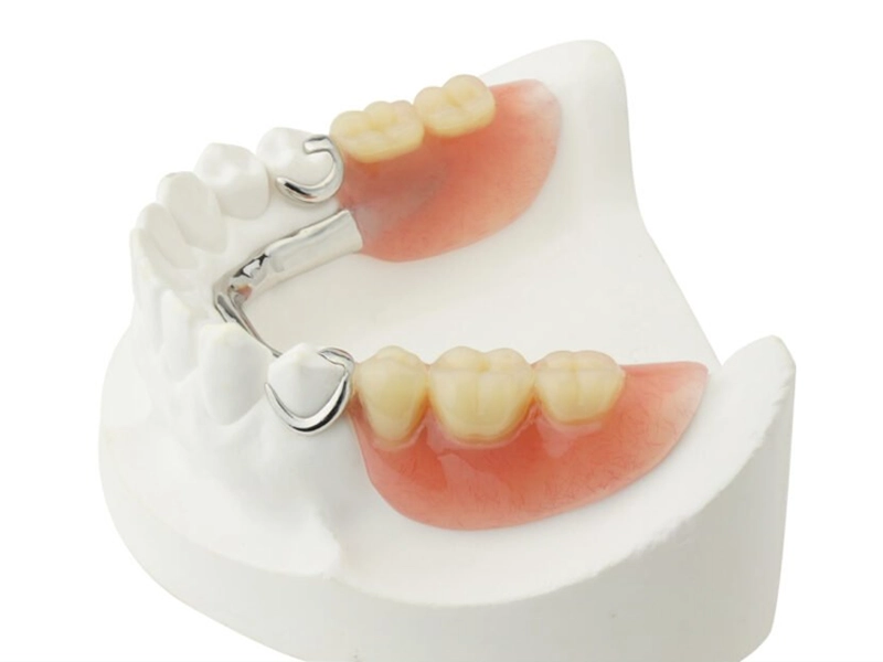 Cosmetic Dentistry Miami, Miami Teeth Whitening, Dental Veneers Miami FL, Best Cosmetic Dentist Miami, True Dentistry Plus Services, Dental Implants Miami, Permanent Tooth Replacement Miami, True Dentistry Plus Dental Implants, Best Implant Dentist in Miami, Miami Dental Implant Services, Dentures Miami, Custom Dentures Miami FL, Full Dentures Miami, Partial Dentures Miami, True Dentistry Plus Dentures, Gum Contouring Miami, Miami Gum Reshaping, Cosmetic Gum Surgery Miami FL, True Dentistry Plus Gum Contouring, Smile Enhancement Miami, Porcelain Crowns Miami, Durable Dental Crowns Miami FL, True Dentistry Plus Crowns, Cosmetic Dental Crowns Miami, Natural-Looking Crowns Miami, Smile Makeover Miami, True Dentistry Plus Smile Enhancement, Miami Smile Design, Full Smile Restoration Miami, Professional Teeth Bleaching Miami, True Dentistry Plus Whitening Services, Miami Cosmetic Teeth Whitening, Best Teeth Whitening Miami FL, Porcelain Veneers Miami FL, True Dentistry Plus Veneers, Cosmetic Veneers Miami, Best Veneers Dentist in Miami, Emergency Dentist Miami, 24/7 Dental Care Miami FL, Urgent Dental Care Miami, True Dentistry Plus Emergency Services, Miami Emergency Dental Services, Miami Dentist, Dental Care Miami FL, Family Dentistry Miami, Dental Health Blog Miami, True Dentistry Plus Blog, Miami Dental Care Tips, Dental News Miami FL, Oral Health Insights Miami, Contact True Dentistry Plus, Miami Dentist Contact, Schedule Dental Appointment Miami, Dental Office Location Miami, True Dentistry Plus Phone Number, Dental Deals Miami, True Dentistry Plus Specials, Miami Dental Offers, Teeth Whitening Discounts Miami, Invisalign Promotion Miami, Oral Surgery Miami, Wisdom Tooth Extraction Miami FL, True Dentistry Plus Oral Surgeons, Miami Oral Surgery Clinic, Tooth Extractions Miami, Bone Grafting Miami FL, Dental Surgery Miami, True Dentistry Plus Extractions, Miami Bone Graft Procedures, LANAP Miami, Laser Gum Therapy Miami FL, Minimally Invasive Gum Treatment Miami, True Dentistry Plus LANAP, Gum Disease Treatment Miami, Sinus Lift Surgery Miami, Dental Implant Preparation Miami, True Dentistry Plus Sinus Lift, Sinus Augmentation Miami, Wisdom Tooth Extractions Miami, Remove Wisdom Teeth Miami FL, Oral Surgery for Wisdom Teeth Miami, Miami Wisdom Teeth Removal, Orthodontics Miami, Braces Miami FL, Invisalign Miami, True Dentistry Plus Orthodontics, Teeth Straightening Miami, Clear Aligners Miami FL, True Dentistry Plus Invisalign, Invisalign Dentist Miami, Invisible Braces Miami, Preventive Dentistry Miami, Dental Cleanings Miami FL, Oral Exams Miami, True Dentistry Plus Preventive Care, Miami Dental Checkups, Comprehensive Dental Exams Miami, Full Oral Exam Miami FL, Dental Checkup Miami, True Dentistry Plus Exams, Dental Hygiene Miami, Teeth Cleaning Miami FL, Oral Hygiene Services Miami, True Dentistry Plus Dental Cleanings, Preventive Dental Care Miami, Nightguards Miami, Custom Mouthguards Miami FL, Teeth Grinding Protection Miami, Bruxism Treatment Miami, True Dentistry Plus Nightguards, Oral Cancer Screening Miami, Early Detection Oral Cancer Miami FL, Oral Health Screening Miami, True Dentistry Plus Screenings, Periodontics Miami, Deep Cleaning Dentist Miami, True Dentistry Plus Periodontics, Scaling and Root Planing Miami, Sleep Apnea Therapy Miami, Snoring Treatment Miami FL, Sleep Apnea Dentist Miami, Oral Appliance Therapy Miami, True Dentistry Plus Sleep Solutions, TMJ Treatment Miami, TMD Therapy Miami FL, Jaw Pain Relief Miami, True Dentistry Plus TMJ Specialist, TMJ Dentist Miami, Restorative Dentistry Miami, Dental Crowns and Bridges Miami FL, Tooth Repair Miami, True Dentistry Plus Restorations, Dental Bridges Miami, Replace Missing Teeth Miami FL, Tooth Bridge Miami, True Dentistry Plus Dental Bridges, Fixed Dental Bridge Miami, Dental Fillings Miami, Cavity Treatment Miami FL, Tooth Fillings Miami, Composite Fillings Miami, True Dentistry Plus Fillings, Smile Restoration Miami FL, Complete Dental Makeover Miami, True Dentistry Plus Reconstruction, Rebuild Smile Miami, Full-Arch Dental Implants Miami, All-on-4 Implants Miami FL, Full Mouth Implants Miami, True Dentistry Plus Implants, Root Canal Miami, Endodontic Treatment Miami FL, Tooth Pain Relief Miami, True Dentistry Plus Root Canal, Save Infected Tooth Miami