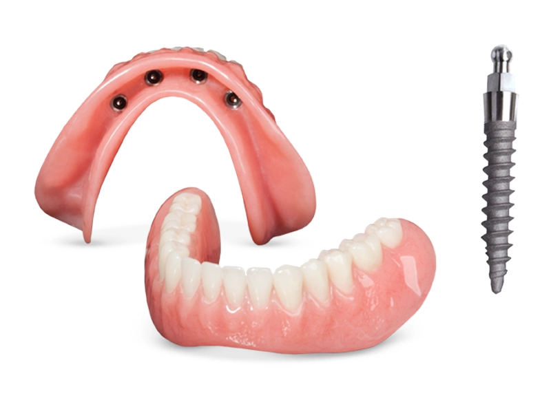 Cosmetic Dentistry Miami, Miami Teeth Whitening, Dental Veneers Miami FL, Best Cosmetic Dentist Miami, True Dentistry Plus Services, Dental Implants Miami, Permanent Tooth Replacement Miami, True Dentistry Plus Dental Implants, Best Implant Dentist in Miami, Miami Dental Implant Services, Dentures Miami, Custom Dentures Miami FL, Full Dentures Miami, Partial Dentures Miami, True Dentistry Plus Dentures, Gum Contouring Miami, Miami Gum Reshaping, Cosmetic Gum Surgery Miami FL, True Dentistry Plus Gum Contouring, Smile Enhancement Miami, Porcelain Crowns Miami, Durable Dental Crowns Miami FL, True Dentistry Plus Crowns, Cosmetic Dental Crowns Miami, Natural-Looking Crowns Miami, Smile Makeover Miami, True Dentistry Plus Smile Enhancement, Miami Smile Design, Full Smile Restoration Miami, Professional Teeth Bleaching Miami, True Dentistry Plus Whitening Services, Miami Cosmetic Teeth Whitening, Best Teeth Whitening Miami FL, Porcelain Veneers Miami FL, True Dentistry Plus Veneers, Cosmetic Veneers Miami, Best Veneers Dentist in Miami, Emergency Dentist Miami, 24/7 Dental Care Miami FL, Urgent Dental Care Miami, True Dentistry Plus Emergency Services, Miami Emergency Dental Services, Miami Dentist, Dental Care Miami FL, Family Dentistry Miami, Dental Health Blog Miami, True Dentistry Plus Blog, Miami Dental Care Tips, Dental News Miami FL, Oral Health Insights Miami, Contact True Dentistry Plus, Miami Dentist Contact, Schedule Dental Appointment Miami, Dental Office Location Miami, True Dentistry Plus Phone Number, Dental Deals Miami, True Dentistry Plus Specials, Miami Dental Offers, Teeth Whitening Discounts Miami, Invisalign Promotion Miami, Oral Surgery Miami, Wisdom Tooth Extraction Miami FL, True Dentistry Plus Oral Surgeons, Miami Oral Surgery Clinic, Tooth Extractions Miami, Bone Grafting Miami FL, Dental Surgery Miami, True Dentistry Plus Extractions, Miami Bone Graft Procedures, LANAP Miami, Laser Gum Therapy Miami FL, Minimally Invasive Gum Treatment Miami, True Dentistry Plus LANAP, Gum Disease Treatment Miami, Sinus Lift Surgery Miami, Dental Implant Preparation Miami, True Dentistry Plus Sinus Lift, Sinus Augmentation Miami, Wisdom Tooth Extractions Miami, Remove Wisdom Teeth Miami FL, Oral Surgery for Wisdom Teeth Miami, Miami Wisdom Teeth Removal, Orthodontics Miami, Braces Miami FL, Invisalign Miami, True Dentistry Plus Orthodontics, Teeth Straightening Miami, Clear Aligners Miami FL, True Dentistry Plus Invisalign, Invisalign Dentist Miami, Invisible Braces Miami, Preventive Dentistry Miami, Dental Cleanings Miami FL, Oral Exams Miami, True Dentistry Plus Preventive Care, Miami Dental Checkups, Comprehensive Dental Exams Miami, Full Oral Exam Miami FL, Dental Checkup Miami, True Dentistry Plus Exams, Dental Hygiene Miami, Teeth Cleaning Miami FL, Oral Hygiene Services Miami, True Dentistry Plus Dental Cleanings, Preventive Dental Care Miami, Nightguards Miami, Custom Mouthguards Miami FL, Teeth Grinding Protection Miami, Bruxism Treatment Miami, True Dentistry Plus Nightguards, Oral Cancer Screening Miami, Early Detection Oral Cancer Miami FL, Oral Health Screening Miami, True Dentistry Plus Screenings, Periodontics Miami, Deep Cleaning Dentist Miami, True Dentistry Plus Periodontics, Scaling and Root Planing Miami, Sleep Apnea Therapy Miami, Snoring Treatment Miami FL, Sleep Apnea Dentist Miami, Oral Appliance Therapy Miami, True Dentistry Plus Sleep Solutions, TMJ Treatment Miami, TMD Therapy Miami FL, Jaw Pain Relief Miami, True Dentistry Plus TMJ Specialist, TMJ Dentist Miami, Restorative Dentistry Miami, Dental Crowns and Bridges Miami FL, Tooth Repair Miami, True Dentistry Plus Restorations, Dental Bridges Miami, Replace Missing Teeth Miami FL, Tooth Bridge Miami, True Dentistry Plus Dental Bridges, Fixed Dental Bridge Miami, Dental Fillings Miami, Cavity Treatment Miami FL, Tooth Fillings Miami, Composite Fillings Miami, True Dentistry Plus Fillings, Smile Restoration Miami FL, Complete Dental Makeover Miami, True Dentistry Plus Reconstruction, Rebuild Smile Miami, Full-Arch Dental Implants Miami, All-on-4 Implants Miami FL, Full Mouth Implants Miami, True Dentistry Plus Implants, Root Canal Miami, Endodontic Treatment Miami FL, Tooth Pain Relief Miami, True Dentistry Plus Root Canal, Save Infected Tooth Miami