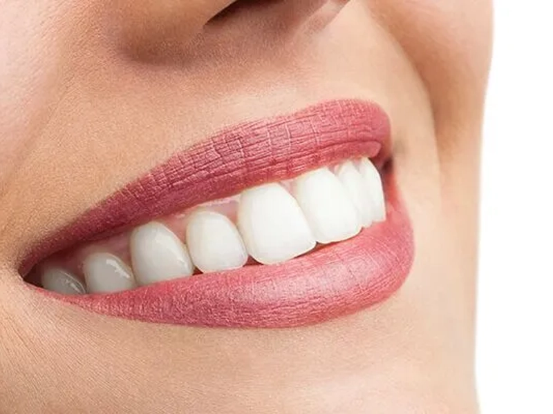 Cosmetic Dentistry Miami, Miami Teeth Whitening, Dental Veneers Miami FL, Best Cosmetic Dentist Miami, True Dentistry Plus Services, Dental Implants Miami, Permanent Tooth Replacement Miami, True Dentistry Plus Dental Implants, Best Implant Dentist in Miami, Miami Dental Implant Services, Dentures Miami, Custom Dentures Miami FL, Full Dentures Miami, Partial Dentures Miami, True Dentistry Plus Dentures, Gum Contouring Miami, Miami Gum Reshaping, Cosmetic Gum Surgery Miami FL, True Dentistry Plus Gum Contouring, Smile Enhancement Miami, Porcelain Crowns Miami, Durable Dental Crowns Miami FL, True Dentistry Plus Crowns, Cosmetic Dental Crowns Miami, Natural-Looking Crowns Miami, Smile Makeover Miami, True Dentistry Plus Smile Enhancement, Miami Smile Design, Full Smile Restoration Miami, Professional Teeth Bleaching Miami, True Dentistry Plus Whitening Services, Miami Cosmetic Teeth Whitening, Best Teeth Whitening Miami FL, Porcelain Veneers Miami FL, True Dentistry Plus Veneers, Cosmetic Veneers Miami, Best Veneers Dentist in Miami, Emergency Dentist Miami, 24/7 Dental Care Miami FL, Urgent Dental Care Miami, True Dentistry Plus Emergency Services, Miami Emergency Dental Services, Miami Dentist, Dental Care Miami FL, Family Dentistry Miami, Dental Health Blog Miami, True Dentistry Plus Blog, Miami Dental Care Tips, Dental News Miami FL, Oral Health Insights Miami, Contact True Dentistry Plus, Miami Dentist Contact, Schedule Dental Appointment Miami, Dental Office Location Miami, True Dentistry Plus Phone Number, Dental Deals Miami, True Dentistry Plus Specials, Miami Dental Offers, Teeth Whitening Discounts Miami, Invisalign Promotion Miami, Oral Surgery Miami, Wisdom Tooth Extraction Miami FL, True Dentistry Plus Oral Surgeons, Miami Oral Surgery Clinic, Tooth Extractions Miami, Bone Grafting Miami FL, Dental Surgery Miami, True Dentistry Plus Extractions, Miami Bone Graft Procedures, LANAP Miami, Laser Gum Therapy Miami FL, Minimally Invasive Gum Treatment Miami, True Dentistry Plus LANAP, Gum Disease Treatment Miami, Sinus Lift Surgery Miami, Dental Implant Preparation Miami, True Dentistry Plus Sinus Lift, Sinus Augmentation Miami, Wisdom Tooth Extractions Miami, Remove Wisdom Teeth Miami FL, Oral Surgery for Wisdom Teeth Miami, Miami Wisdom Teeth Removal, Orthodontics Miami, Braces Miami FL, Invisalign Miami, True Dentistry Plus Orthodontics, Teeth Straightening Miami, Clear Aligners Miami FL, True Dentistry Plus Invisalign, Invisalign Dentist Miami, Invisible Braces Miami, Preventive Dentistry Miami, Dental Cleanings Miami FL, Oral Exams Miami, True Dentistry Plus Preventive Care, Miami Dental Checkups, Comprehensive Dental Exams Miami, Full Oral Exam Miami FL, Dental Checkup Miami, True Dentistry Plus Exams, Dental Hygiene Miami, Teeth Cleaning Miami FL, Oral Hygiene Services Miami, True Dentistry Plus Dental Cleanings, Preventive Dental Care Miami, Nightguards Miami, Custom Mouthguards Miami FL, Teeth Grinding Protection Miami, Bruxism Treatment Miami, True Dentistry Plus Nightguards, Oral Cancer Screening Miami, Early Detection Oral Cancer Miami FL, Oral Health Screening Miami, True Dentistry Plus Screenings, Periodontics Miami, Deep Cleaning Dentist Miami, True Dentistry Plus Periodontics, Scaling and Root Planing Miami, Sleep Apnea Therapy Miami, Snoring Treatment Miami FL, Sleep Apnea Dentist Miami, Oral Appliance Therapy Miami, True Dentistry Plus Sleep Solutions, TMJ Treatment Miami, TMD Therapy Miami FL, Jaw Pain Relief Miami, True Dentistry Plus TMJ Specialist, TMJ Dentist Miami, Restorative Dentistry Miami, Dental Crowns and Bridges Miami FL, Tooth Repair Miami, True Dentistry Plus Restorations, Dental Bridges Miami, Replace Missing Teeth Miami FL, Tooth Bridge Miami, True Dentistry Plus Dental Bridges, Fixed Dental Bridge Miami, Dental Fillings Miami, Cavity Treatment Miami FL, Tooth Fillings Miami, Composite Fillings Miami, True Dentistry Plus Fillings, Smile Restoration Miami FL, Complete Dental Makeover Miami, True Dentistry Plus Reconstruction, Rebuild Smile Miami, Full-Arch Dental Implants Miami, All-on-4 Implants Miami FL, Full Mouth Implants Miami, True Dentistry Plus Implants, Root Canal Miami, Endodontic Treatment Miami FL, Tooth Pain Relief Miami, True Dentistry Plus Root Canal, Save Infected Tooth Miami