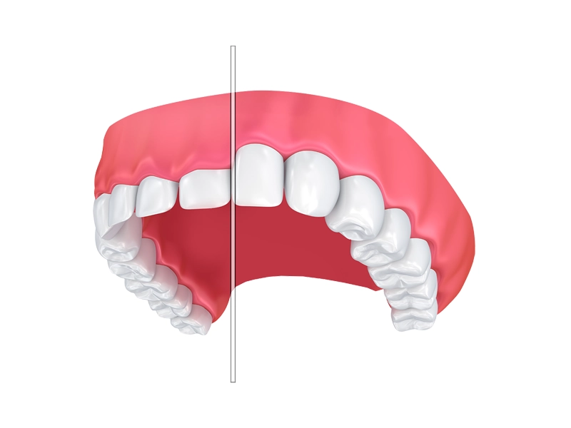 Cosmetic Dentistry Miami, Miami Teeth Whitening, Dental Veneers Miami FL, Best Cosmetic Dentist Miami, True Dentistry Plus Services, Dental Implants Miami, Permanent Tooth Replacement Miami, True Dentistry Plus Dental Implants, Best Implant Dentist in Miami, Miami Dental Implant Services, Dentures Miami, Custom Dentures Miami FL, Full Dentures Miami, Partial Dentures Miami, True Dentistry Plus Dentures, Gum Contouring Miami, Miami Gum Reshaping, Cosmetic Gum Surgery Miami FL, True Dentistry Plus Gum Contouring, Smile Enhancement Miami, Porcelain Crowns Miami, Durable Dental Crowns Miami FL, True Dentistry Plus Crowns, Cosmetic Dental Crowns Miami, Natural-Looking Crowns Miami, Smile Makeover Miami, True Dentistry Plus Smile Enhancement, Miami Smile Design, Full Smile Restoration Miami, Professional Teeth Bleaching Miami, True Dentistry Plus Whitening Services, Miami Cosmetic Teeth Whitening, Best Teeth Whitening Miami FL, Porcelain Veneers Miami FL, True Dentistry Plus Veneers, Cosmetic Veneers Miami, Best Veneers Dentist in Miami, Emergency Dentist Miami, 24/7 Dental Care Miami FL, Urgent Dental Care Miami, True Dentistry Plus Emergency Services, Miami Emergency Dental Services, Miami Dentist, Dental Care Miami FL, Family Dentistry Miami, Dental Health Blog Miami, True Dentistry Plus Blog, Miami Dental Care Tips, Dental News Miami FL, Oral Health Insights Miami, Contact True Dentistry Plus, Miami Dentist Contact, Schedule Dental Appointment Miami, Dental Office Location Miami, True Dentistry Plus Phone Number, Dental Deals Miami, True Dentistry Plus Specials, Miami Dental Offers, Teeth Whitening Discounts Miami, Invisalign Promotion Miami, Oral Surgery Miami, Wisdom Tooth Extraction Miami FL, True Dentistry Plus Oral Surgeons, Miami Oral Surgery Clinic, Tooth Extractions Miami, Bone Grafting Miami FL, Dental Surgery Miami, True Dentistry Plus Extractions, Miami Bone Graft Procedures, LANAP Miami, Laser Gum Therapy Miami FL, Minimally Invasive Gum Treatment Miami, True Dentistry Plus LANAP, Gum Disease Treatment Miami, Sinus Lift Surgery Miami, Dental Implant Preparation Miami, True Dentistry Plus Sinus Lift, Sinus Augmentation Miami, Wisdom Tooth Extractions Miami, Remove Wisdom Teeth Miami FL, Oral Surgery for Wisdom Teeth Miami, Miami Wisdom Teeth Removal, Orthodontics Miami, Braces Miami FL, Invisalign Miami, True Dentistry Plus Orthodontics, Teeth Straightening Miami, Clear Aligners Miami FL, True Dentistry Plus Invisalign, Invisalign Dentist Miami, Invisible Braces Miami, Preventive Dentistry Miami, Dental Cleanings Miami FL, Oral Exams Miami, True Dentistry Plus Preventive Care, Miami Dental Checkups, Comprehensive Dental Exams Miami, Full Oral Exam Miami FL, Dental Checkup Miami, True Dentistry Plus Exams, Dental Hygiene Miami, Teeth Cleaning Miami FL, Oral Hygiene Services Miami, True Dentistry Plus Dental Cleanings, Preventive Dental Care Miami, Nightguards Miami, Custom Mouthguards Miami FL, Teeth Grinding Protection Miami, Bruxism Treatment Miami, True Dentistry Plus Nightguards, Oral Cancer Screening Miami, Early Detection Oral Cancer Miami FL, Oral Health Screening Miami, True Dentistry Plus Screenings, Periodontics Miami, Deep Cleaning Dentist Miami, True Dentistry Plus Periodontics, Scaling and Root Planing Miami, Sleep Apnea Therapy Miami, Snoring Treatment Miami FL, Sleep Apnea Dentist Miami, Oral Appliance Therapy Miami, True Dentistry Plus Sleep Solutions, TMJ Treatment Miami, TMD Therapy Miami FL, Jaw Pain Relief Miami, True Dentistry Plus TMJ Specialist, TMJ Dentist Miami, Restorative Dentistry Miami, Dental Crowns and Bridges Miami FL, Tooth Repair Miami, True Dentistry Plus Restorations, Dental Bridges Miami, Replace Missing Teeth Miami FL, Tooth Bridge Miami, True Dentistry Plus Dental Bridges, Fixed Dental Bridge Miami, Dental Fillings Miami, Cavity Treatment Miami FL, Tooth Fillings Miami, Composite Fillings Miami, True Dentistry Plus Fillings, Smile Restoration Miami FL, Complete Dental Makeover Miami, True Dentistry Plus Reconstruction, Rebuild Smile Miami, Full-Arch Dental Implants Miami, All-on-4 Implants Miami FL, Full Mouth Implants Miami, True Dentistry Plus Implants, Root Canal Miami, Endodontic Treatment Miami FL, Tooth Pain Relief Miami, True Dentistry Plus Root Canal, Save Infected Tooth Miami