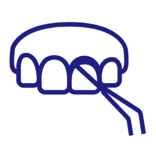 Cosmetic Dentistry Miami, Miami Teeth Whitening, Dental Veneers Miami FL, Best Cosmetic Dentist Miami, True Dentistry Plus Services, Dental Implants Miami, Permanent Tooth Replacement Miami, True Dentistry Plus Dental Implants, Best Implant Dentist in Miami, Miami Dental Implant Services, Dentures Miami, Custom Dentures Miami FL, Full Dentures Miami, Partial Dentures Miami, True Dentistry Plus Dentures, Gum Contouring Miami, Miami Gum Reshaping, Cosmetic Gum Surgery Miami FL, True Dentistry Plus Gum Contouring, Smile Enhancement Miami, Porcelain Crowns Miami, Durable Dental Crowns Miami FL, True Dentistry Plus Crowns, Cosmetic Dental Crowns Miami, Natural-Looking Crowns Miami, Smile Makeover Miami, True Dentistry Plus Smile Enhancement, Miami Smile Design, Full Smile Restoration Miami, Professional Teeth Bleaching Miami, True Dentistry Plus Whitening Services, Miami Cosmetic Teeth Whitening, Best Teeth Whitening Miami FL, Porcelain Veneers Miami FL, True Dentistry Plus Veneers, Cosmetic Veneers Miami, Best Veneers Dentist in Miami, Emergency Dentist Miami, 24/7 Dental Care Miami FL, Urgent Dental Care Miami, True Dentistry Plus Emergency Services, Miami Emergency Dental Services, Miami Dentist, Dental Care Miami FL, Family Dentistry Miami, Dental Health Blog Miami, True Dentistry Plus Blog, Miami Dental Care Tips, Dental News Miami FL, Oral Health Insights Miami, Contact True Dentistry Plus, Miami Dentist Contact, Schedule Dental Appointment Miami, Dental Office Location Miami, True Dentistry Plus Phone Number, Dental Deals Miami, True Dentistry Plus Specials, Miami Dental Offers, Teeth Whitening Discounts Miami, Invisalign Promotion Miami, Oral Surgery Miami, Wisdom Tooth Extraction Miami FL, True Dentistry Plus Oral Surgeons, Miami Oral Surgery Clinic, Tooth Extractions Miami, Bone Grafting Miami FL, Dental Surgery Miami, True Dentistry Plus Extractions, Miami Bone Graft Procedures, LANAP Miami, Laser Gum Therapy Miami FL, Minimally Invasive Gum Treatment Miami, True Dentistry Plus LANAP, Gum Disease Treatment Miami, Sinus Lift Surgery Miami, Dental Implant Preparation Miami, True Dentistry Plus Sinus Lift, Sinus Augmentation Miami, Wisdom Tooth Extractions Miami, Remove Wisdom Teeth Miami FL, Oral Surgery for Wisdom Teeth Miami, Miami Wisdom Teeth Removal, Orthodontics Miami, Braces Miami FL, Invisalign Miami, True Dentistry Plus Orthodontics, Teeth Straightening Miami, Clear Aligners Miami FL, True Dentistry Plus Invisalign, Invisalign Dentist Miami, Invisible Braces Miami, Preventive Dentistry Miami, Dental Cleanings Miami FL, Oral Exams Miami, True Dentistry Plus Preventive Care, Miami Dental Checkups, Comprehensive Dental Exams Miami, Full Oral Exam Miami FL, Dental Checkup Miami, True Dentistry Plus Exams, Dental Hygiene Miami, Teeth Cleaning Miami FL, Oral Hygiene Services Miami, True Dentistry Plus Dental Cleanings, Preventive Dental Care Miami, Nightguards Miami, Custom Mouthguards Miami FL, Teeth Grinding Protection Miami, Bruxism Treatment Miami, True Dentistry Plus Nightguards, Oral Cancer Screening Miami, Early Detection Oral Cancer Miami FL, Oral Health Screening Miami, True Dentistry Plus Screenings, Periodontics Miami, Deep Cleaning Dentist Miami, True Dentistry Plus Periodontics, Scaling and Root Planing Miami, Sleep Apnea Therapy Miami, Snoring Treatment Miami FL, Sleep Apnea Dentist Miami, Oral Appliance Therapy Miami, True Dentistry Plus Sleep Solutions, TMJ Treatment Miami, TMD Therapy Miami FL, Jaw Pain Relief Miami, True Dentistry Plus TMJ Specialist, TMJ Dentist Miami, Restorative Dentistry Miami, Dental Crowns and Bridges Miami FL, Tooth Repair Miami, True Dentistry Plus Restorations, Dental Bridges Miami, Replace Missing Teeth Miami FL, Tooth Bridge Miami, True Dentistry Plus Dental Bridges, Fixed Dental Bridge Miami, Dental Fillings Miami, Cavity Treatment Miami FL, Tooth Fillings Miami, Composite Fillings Miami, True Dentistry Plus Fillings, Smile Restoration Miami FL, Complete Dental Makeover Miami, True Dentistry Plus Reconstruction, Rebuild Smile Miami, Full-Arch Dental Implants Miami, All-on-4 Implants Miami FL, Full Mouth Implants Miami, True Dentistry Plus Implants, Root Canal Miami, Endodontic Treatment Miami FL, Tooth Pain Relief Miami, True Dentistry Plus Root Canal, Save Infected Tooth Miami