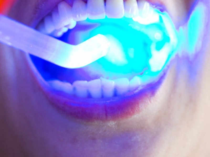 Cosmetic Dentistry Miami, Miami Teeth Whitening, Dental Veneers Miami FL, Best Cosmetic Dentist Miami, True Dentistry Plus Services, Dental Implants Miami, Permanent Tooth Replacement Miami, True Dentistry Plus Dental Implants, Best Implant Dentist in Miami, Miami Dental Implant Services, Dentures Miami, Custom Dentures Miami FL, Full Dentures Miami, Partial Dentures Miami, True Dentistry Plus Dentures, Gum Contouring Miami, Miami Gum Reshaping, Cosmetic Gum Surgery Miami FL, True Dentistry Plus Gum Contouring, Smile Enhancement Miami, Porcelain Crowns Miami, Durable Dental Crowns Miami FL, True Dentistry Plus Crowns, Cosmetic Dental Crowns Miami, Natural-Looking Crowns Miami, Smile Makeover Miami, True Dentistry Plus Smile Enhancement, Miami Smile Design, Full Smile Restoration Miami, Professional Teeth Bleaching Miami, True Dentistry Plus Whitening Services, Miami Cosmetic Teeth Whitening, Best Teeth Whitening Miami FL, Porcelain Veneers Miami FL, True Dentistry Plus Veneers, Cosmetic Veneers Miami, Best Veneers Dentist in Miami, Emergency Dentist Miami, 24/7 Dental Care Miami FL, Urgent Dental Care Miami, True Dentistry Plus Emergency Services, Miami Emergency Dental Services, Miami Dentist, Dental Care Miami FL, Family Dentistry Miami, Dental Health Blog Miami, True Dentistry Plus Blog, Miami Dental Care Tips, Dental News Miami FL, Oral Health Insights Miami, Contact True Dentistry Plus, Miami Dentist Contact, Schedule Dental Appointment Miami, Dental Office Location Miami, True Dentistry Plus Phone Number, Dental Deals Miami, True Dentistry Plus Specials, Miami Dental Offers, Teeth Whitening Discounts Miami, Invisalign Promotion Miami, Oral Surgery Miami, Wisdom Tooth Extraction Miami FL, True Dentistry Plus Oral Surgeons, Miami Oral Surgery Clinic, Tooth Extractions Miami, Bone Grafting Miami FL, Dental Surgery Miami, True Dentistry Plus Extractions, Miami Bone Graft Procedures, LANAP Miami, Laser Gum Therapy Miami FL, Minimally Invasive Gum Treatment Miami, True Dentistry Plus LANAP, Gum Disease Treatment Miami, Sinus Lift Surgery Miami, Dental Implant Preparation Miami, True Dentistry Plus Sinus Lift, Sinus Augmentation Miami, Wisdom Tooth Extractions Miami, Remove Wisdom Teeth Miami FL, Oral Surgery for Wisdom Teeth Miami, Miami Wisdom Teeth Removal, Orthodontics Miami, Braces Miami FL, Invisalign Miami, True Dentistry Plus Orthodontics, Teeth Straightening Miami, Clear Aligners Miami FL, True Dentistry Plus Invisalign, Invisalign Dentist Miami, Invisible Braces Miami, Preventive Dentistry Miami, Dental Cleanings Miami FL, Oral Exams Miami, True Dentistry Plus Preventive Care, Miami Dental Checkups, Comprehensive Dental Exams Miami, Full Oral Exam Miami FL, Dental Checkup Miami, True Dentistry Plus Exams, Dental Hygiene Miami, Teeth Cleaning Miami FL, Oral Hygiene Services Miami, True Dentistry Plus Dental Cleanings, Preventive Dental Care Miami, Nightguards Miami, Custom Mouthguards Miami FL, Teeth Grinding Protection Miami, Bruxism Treatment Miami, True Dentistry Plus Nightguards, Oral Cancer Screening Miami, Early Detection Oral Cancer Miami FL, Oral Health Screening Miami, True Dentistry Plus Screenings, Periodontics Miami, Deep Cleaning Dentist Miami, True Dentistry Plus Periodontics, Scaling and Root Planing Miami, Sleep Apnea Therapy Miami, Snoring Treatment Miami FL, Sleep Apnea Dentist Miami, Oral Appliance Therapy Miami, True Dentistry Plus Sleep Solutions, TMJ Treatment Miami, TMD Therapy Miami FL, Jaw Pain Relief Miami, True Dentistry Plus TMJ Specialist, TMJ Dentist Miami, Restorative Dentistry Miami, Dental Crowns and Bridges Miami FL, Tooth Repair Miami, True Dentistry Plus Restorations, Dental Bridges Miami, Replace Missing Teeth Miami FL, Tooth Bridge Miami, True Dentistry Plus Dental Bridges, Fixed Dental Bridge Miami, Dental Fillings Miami, Cavity Treatment Miami FL, Tooth Fillings Miami, Composite Fillings Miami, True Dentistry Plus Fillings, Smile Restoration Miami FL, Complete Dental Makeover Miami, True Dentistry Plus Reconstruction, Rebuild Smile Miami, Full-Arch Dental Implants Miami, All-on-4 Implants Miami FL, Full Mouth Implants Miami, True Dentistry Plus Implants, Root Canal Miami, Endodontic Treatment Miami FL, Tooth Pain Relief Miami, True Dentistry Plus Root Canal, Save Infected Tooth Miami