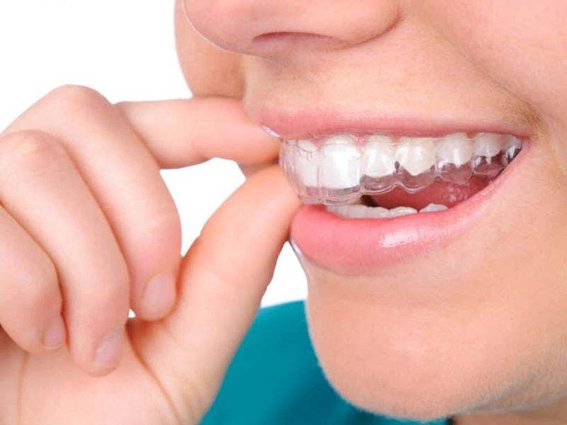 Cosmetic Dentistry Miami, Miami Teeth Whitening, Dental Veneers Miami FL, Best Cosmetic Dentist Miami, True Dentistry Plus Services, Dental Implants Miami, Permanent Tooth Replacement Miami, True Dentistry Plus Dental Implants, Best Implant Dentist in Miami, Miami Dental Implant Services, Dentures Miami, Custom Dentures Miami FL, Full Dentures Miami, Partial Dentures Miami, True Dentistry Plus Dentures, Gum Contouring Miami, Miami Gum Reshaping, Cosmetic Gum Surgery Miami FL, True Dentistry Plus Gum Contouring, Smile Enhancement Miami, Porcelain Crowns Miami, Durable Dental Crowns Miami FL, True Dentistry Plus Crowns, Cosmetic Dental Crowns Miami, Natural-Looking Crowns Miami, Smile Makeover Miami, True Dentistry Plus Smile Enhancement, Miami Smile Design, Full Smile Restoration Miami, Professional Teeth Bleaching Miami, True Dentistry Plus Whitening Services, Miami Cosmetic Teeth Whitening, Best Teeth Whitening Miami FL, Porcelain Veneers Miami FL, True Dentistry Plus Veneers, Cosmetic Veneers Miami, Best Veneers Dentist in Miami, Emergency Dentist Miami, 24/7 Dental Care Miami FL, Urgent Dental Care Miami, True Dentistry Plus Emergency Services, Miami Emergency Dental Services, Miami Dentist, Dental Care Miami FL, Family Dentistry Miami, Dental Health Blog Miami, True Dentistry Plus Blog, Miami Dental Care Tips, Dental News Miami FL, Oral Health Insights Miami, Contact True Dentistry Plus, Miami Dentist Contact, Schedule Dental Appointment Miami, Dental Office Location Miami, True Dentistry Plus Phone Number, Dental Deals Miami, True Dentistry Plus Specials, Miami Dental Offers, Teeth Whitening Discounts Miami, Invisalign Promotion Miami, Oral Surgery Miami, Wisdom Tooth Extraction Miami FL, True Dentistry Plus Oral Surgeons, Miami Oral Surgery Clinic, Tooth Extractions Miami, Bone Grafting Miami FL, Dental Surgery Miami, True Dentistry Plus Extractions, Miami Bone Graft Procedures, LANAP Miami, Laser Gum Therapy Miami FL, Minimally Invasive Gum Treatment Miami, True Dentistry Plus LANAP, Gum Disease Treatment Miami, Sinus Lift Surgery Miami, Dental Implant Preparation Miami, True Dentistry Plus Sinus Lift, Sinus Augmentation Miami, Wisdom Tooth Extractions Miami, Remove Wisdom Teeth Miami FL, Oral Surgery for Wisdom Teeth Miami, Miami Wisdom Teeth Removal, Orthodontics Miami, Braces Miami FL, Invisalign Miami, True Dentistry Plus Orthodontics, Teeth Straightening Miami, Clear Aligners Miami FL, True Dentistry Plus Invisalign, Invisalign Dentist Miami, Invisible Braces Miami, Preventive Dentistry Miami, Dental Cleanings Miami FL, Oral Exams Miami, True Dentistry Plus Preventive Care, Miami Dental Checkups, Comprehensive Dental Exams Miami, Full Oral Exam Miami FL, Dental Checkup Miami, True Dentistry Plus Exams, Dental Hygiene Miami, Teeth Cleaning Miami FL, Oral Hygiene Services Miami, True Dentistry Plus Dental Cleanings, Preventive Dental Care Miami, Nightguards Miami, Custom Mouthguards Miami FL, Teeth Grinding Protection Miami, Bruxism Treatment Miami, True Dentistry Plus Nightguards, Oral Cancer Screening Miami, Early Detection Oral Cancer Miami FL, Oral Health Screening Miami, True Dentistry Plus Screenings, Periodontics Miami, Deep Cleaning Dentist Miami, True Dentistry Plus Periodontics, Scaling and Root Planing Miami, Sleep Apnea Therapy Miami, Snoring Treatment Miami FL, Sleep Apnea Dentist Miami, Oral Appliance Therapy Miami, True Dentistry Plus Sleep Solutions, TMJ Treatment Miami, TMD Therapy Miami FL, Jaw Pain Relief Miami, True Dentistry Plus TMJ Specialist, TMJ Dentist Miami, Restorative Dentistry Miami, Dental Crowns and Bridges Miami FL, Tooth Repair Miami, True Dentistry Plus Restorations, Dental Bridges Miami, Replace Missing Teeth Miami FL, Tooth Bridge Miami, True Dentistry Plus Dental Bridges, Fixed Dental Bridge Miami, Dental Fillings Miami, Cavity Treatment Miami FL, Tooth Fillings Miami, Composite Fillings Miami, True Dentistry Plus Fillings, Smile Restoration Miami FL, Complete Dental Makeover Miami, True Dentistry Plus Reconstruction, Rebuild Smile Miami, Full-Arch Dental Implants Miami, All-on-4 Implants Miami FL, Full Mouth Implants Miami, True Dentistry Plus Implants, Root Canal Miami, Endodontic Treatment Miami FL, Tooth Pain Relief Miami, True Dentistry Plus Root Canal, Save Infected Tooth Miami