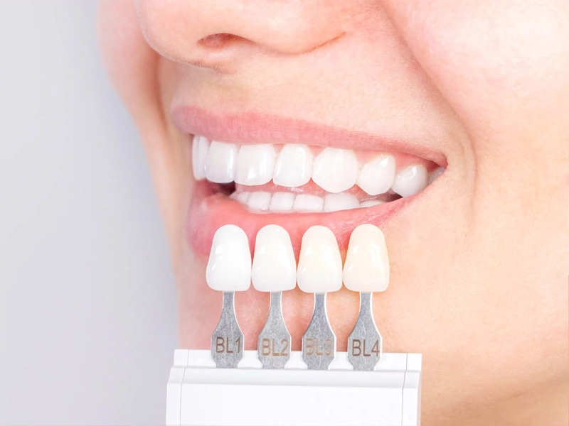 Cosmetic Dentistry Miami, Miami Teeth Whitening, Dental Veneers Miami FL, Best Cosmetic Dentist Miami, True Dentistry Plus Services, Dental Implants Miami, Permanent Tooth Replacement Miami, True Dentistry Plus Dental Implants, Best Implant Dentist in Miami, Miami Dental Implant Services, Dentures Miami, Custom Dentures Miami FL, Full Dentures Miami, Partial Dentures Miami, True Dentistry Plus Dentures, Gum Contouring Miami, Miami Gum Reshaping, Cosmetic Gum Surgery Miami FL, True Dentistry Plus Gum Contouring, Smile Enhancement Miami, Porcelain Crowns Miami, Durable Dental Crowns Miami FL, True Dentistry Plus Crowns, Cosmetic Dental Crowns Miami, Natural-Looking Crowns Miami, Smile Makeover Miami, True Dentistry Plus Smile Enhancement, Miami Smile Design, Full Smile Restoration Miami, Professional Teeth Bleaching Miami, True Dentistry Plus Whitening Services, Miami Cosmetic Teeth Whitening, Best Teeth Whitening Miami FL, Porcelain Veneers Miami FL, True Dentistry Plus Veneers, Cosmetic Veneers Miami, Best Veneers Dentist in Miami, Emergency Dentist Miami, 24/7 Dental Care Miami FL, Urgent Dental Care Miami, True Dentistry Plus Emergency Services, Miami Emergency Dental Services, Miami Dentist, Dental Care Miami FL, Family Dentistry Miami, Dental Health Blog Miami, True Dentistry Plus Blog, Miami Dental Care Tips, Dental News Miami FL, Oral Health Insights Miami, Contact True Dentistry Plus, Miami Dentist Contact, Schedule Dental Appointment Miami, Dental Office Location Miami, True Dentistry Plus Phone Number, Dental Deals Miami, True Dentistry Plus Specials, Miami Dental Offers, Teeth Whitening Discounts Miami, Invisalign Promotion Miami, Oral Surgery Miami, Wisdom Tooth Extraction Miami FL, True Dentistry Plus Oral Surgeons, Miami Oral Surgery Clinic, Tooth Extractions Miami, Bone Grafting Miami FL, Dental Surgery Miami, True Dentistry Plus Extractions, Miami Bone Graft Procedures, LANAP Miami, Laser Gum Therapy Miami FL, Minimally Invasive Gum Treatment Miami, True Dentistry Plus LANAP, Gum Disease Treatment Miami, Sinus Lift Surgery Miami, Dental Implant Preparation Miami, True Dentistry Plus Sinus Lift, Sinus Augmentation Miami, Wisdom Tooth Extractions Miami, Remove Wisdom Teeth Miami FL, Oral Surgery for Wisdom Teeth Miami, Miami Wisdom Teeth Removal, Orthodontics Miami, Braces Miami FL, Invisalign Miami, True Dentistry Plus Orthodontics, Teeth Straightening Miami, Clear Aligners Miami FL, True Dentistry Plus Invisalign, Invisalign Dentist Miami, Invisible Braces Miami, Preventive Dentistry Miami, Dental Cleanings Miami FL, Oral Exams Miami, True Dentistry Plus Preventive Care, Miami Dental Checkups, Comprehensive Dental Exams Miami, Full Oral Exam Miami FL, Dental Checkup Miami, True Dentistry Plus Exams, Dental Hygiene Miami, Teeth Cleaning Miami FL, Oral Hygiene Services Miami, True Dentistry Plus Dental Cleanings, Preventive Dental Care Miami, Nightguards Miami, Custom Mouthguards Miami FL, Teeth Grinding Protection Miami, Bruxism Treatment Miami, True Dentistry Plus Nightguards, Oral Cancer Screening Miami, Early Detection Oral Cancer Miami FL, Oral Health Screening Miami, True Dentistry Plus Screenings, Periodontics Miami, Deep Cleaning Dentist Miami, True Dentistry Plus Periodontics, Scaling and Root Planing Miami, Sleep Apnea Therapy Miami, Snoring Treatment Miami FL, Sleep Apnea Dentist Miami, Oral Appliance Therapy Miami, True Dentistry Plus Sleep Solutions, TMJ Treatment Miami, TMD Therapy Miami FL, Jaw Pain Relief Miami, True Dentistry Plus TMJ Specialist, TMJ Dentist Miami, Restorative Dentistry Miami, Dental Crowns and Bridges Miami FL, Tooth Repair Miami, True Dentistry Plus Restorations, Dental Bridges Miami, Replace Missing Teeth Miami FL, Tooth Bridge Miami, True Dentistry Plus Dental Bridges, Fixed Dental Bridge Miami, Dental Fillings Miami, Cavity Treatment Miami FL, Tooth Fillings Miami, Composite Fillings Miami, True Dentistry Plus Fillings, Smile Restoration Miami FL, Complete Dental Makeover Miami, True Dentistry Plus Reconstruction, Rebuild Smile Miami, Full-Arch Dental Implants Miami, All-on-4 Implants Miami FL, Full Mouth Implants Miami, True Dentistry Plus Implants, Root Canal Miami, Endodontic Treatment Miami FL, Tooth Pain Relief Miami, True Dentistry Plus Root Canal, Save Infected Tooth Miami