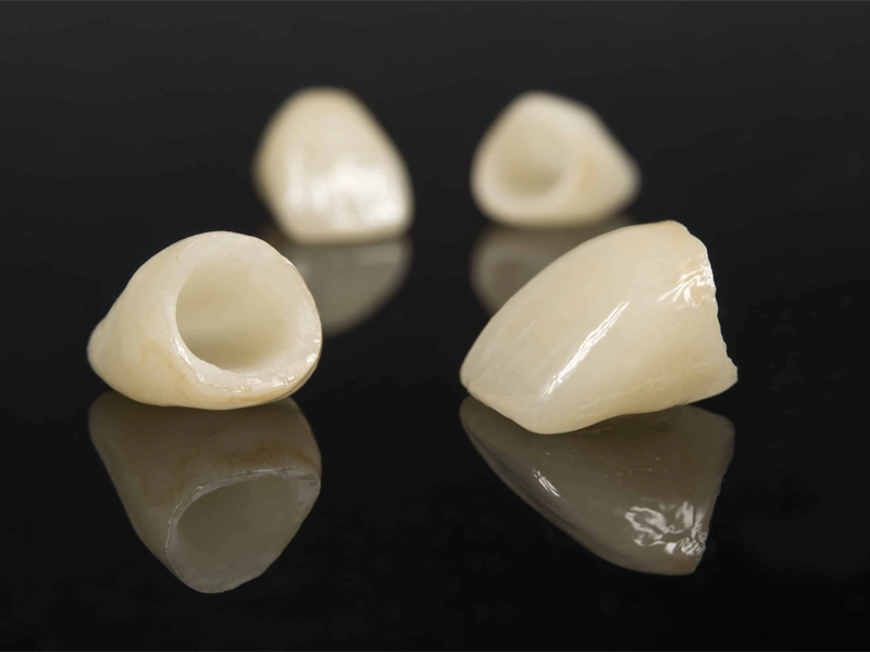 Cosmetic Dentistry Miami, Miami Teeth Whitening, Dental Veneers Miami FL, Best Cosmetic Dentist Miami, True Dentistry Plus Services, Dental Implants Miami, Permanent Tooth Replacement Miami, True Dentistry Plus Dental Implants, Best Implant Dentist in Miami, Miami Dental Implant Services, Dentures Miami, Custom Dentures Miami FL, Full Dentures Miami, Partial Dentures Miami, True Dentistry Plus Dentures, Gum Contouring Miami, Miami Gum Reshaping, Cosmetic Gum Surgery Miami FL, True Dentistry Plus Gum Contouring, Smile Enhancement Miami, Porcelain Crowns Miami, Durable Dental Crowns Miami FL, True Dentistry Plus Crowns, Cosmetic Dental Crowns Miami, Natural-Looking Crowns Miami, Smile Makeover Miami, True Dentistry Plus Smile Enhancement, Miami Smile Design, Full Smile Restoration Miami, Professional Teeth Bleaching Miami, True Dentistry Plus Whitening Services, Miami Cosmetic Teeth Whitening, Best Teeth Whitening Miami FL, Porcelain Veneers Miami FL, True Dentistry Plus Veneers, Cosmetic Veneers Miami, Best Veneers Dentist in Miami, Emergency Dentist Miami, 24/7 Dental Care Miami FL, Urgent Dental Care Miami, True Dentistry Plus Emergency Services, Miami Emergency Dental Services, Miami Dentist, Dental Care Miami FL, Family Dentistry Miami, Dental Health Blog Miami, True Dentistry Plus Blog, Miami Dental Care Tips, Dental News Miami FL, Oral Health Insights Miami, Contact True Dentistry Plus, Miami Dentist Contact, Schedule Dental Appointment Miami, Dental Office Location Miami, True Dentistry Plus Phone Number, Dental Deals Miami, True Dentistry Plus Specials, Miami Dental Offers, Teeth Whitening Discounts Miami, Invisalign Promotion Miami, Oral Surgery Miami, Wisdom Tooth Extraction Miami FL, True Dentistry Plus Oral Surgeons, Miami Oral Surgery Clinic, Tooth Extractions Miami, Bone Grafting Miami FL, Dental Surgery Miami, True Dentistry Plus Extractions, Miami Bone Graft Procedures, LANAP Miami, Laser Gum Therapy Miami FL, Minimally Invasive Gum Treatment Miami, True Dentistry Plus LANAP, Gum Disease Treatment Miami, Sinus Lift Surgery Miami, Dental Implant Preparation Miami, True Dentistry Plus Sinus Lift, Sinus Augmentation Miami, Wisdom Tooth Extractions Miami, Remove Wisdom Teeth Miami FL, Oral Surgery for Wisdom Teeth Miami, Miami Wisdom Teeth Removal, Orthodontics Miami, Braces Miami FL, Invisalign Miami, True Dentistry Plus Orthodontics, Teeth Straightening Miami, Clear Aligners Miami FL, True Dentistry Plus Invisalign, Invisalign Dentist Miami, Invisible Braces Miami, Preventive Dentistry Miami, Dental Cleanings Miami FL, Oral Exams Miami, True Dentistry Plus Preventive Care, Miami Dental Checkups, Comprehensive Dental Exams Miami, Full Oral Exam Miami FL, Dental Checkup Miami, True Dentistry Plus Exams, Dental Hygiene Miami, Teeth Cleaning Miami FL, Oral Hygiene Services Miami, True Dentistry Plus Dental Cleanings, Preventive Dental Care Miami, Nightguards Miami, Custom Mouthguards Miami FL, Teeth Grinding Protection Miami, Bruxism Treatment Miami, True Dentistry Plus Nightguards, Oral Cancer Screening Miami, Early Detection Oral Cancer Miami FL, Oral Health Screening Miami, True Dentistry Plus Screenings, Periodontics Miami, Deep Cleaning Dentist Miami, True Dentistry Plus Periodontics, Scaling and Root Planing Miami, Sleep Apnea Therapy Miami, Snoring Treatment Miami FL, Sleep Apnea Dentist Miami, Oral Appliance Therapy Miami, True Dentistry Plus Sleep Solutions, TMJ Treatment Miami, TMD Therapy Miami FL, Jaw Pain Relief Miami, True Dentistry Plus TMJ Specialist, TMJ Dentist Miami, Restorative Dentistry Miami, Dental Crowns and Bridges Miami FL, Tooth Repair Miami, True Dentistry Plus Restorations, Dental Bridges Miami, Replace Missing Teeth Miami FL, Tooth Bridge Miami, True Dentistry Plus Dental Bridges, Fixed Dental Bridge Miami, Dental Fillings Miami, Cavity Treatment Miami FL, Tooth Fillings Miami, Composite Fillings Miami, True Dentistry Plus Fillings, Smile Restoration Miami FL, Complete Dental Makeover Miami, True Dentistry Plus Reconstruction, Rebuild Smile Miami, Full-Arch Dental Implants Miami, All-on-4 Implants Miami FL, Full Mouth Implants Miami, True Dentistry Plus Implants, Root Canal Miami, Endodontic Treatment Miami FL, Tooth Pain Relief Miami, True Dentistry Plus Root Canal, Save Infected Tooth Miami