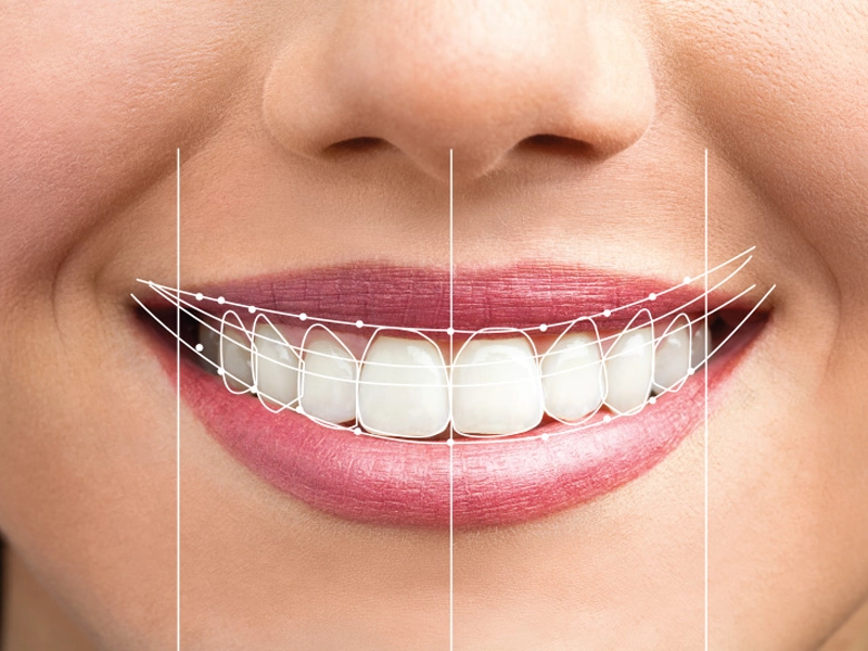 Cosmetic Dentistry Miami, Miami Teeth Whitening, Dental Veneers Miami FL, Best Cosmetic Dentist Miami, True Dentistry Plus Services, Dental Implants Miami, Permanent Tooth Replacement Miami, True Dentistry Plus Dental Implants, Best Implant Dentist in Miami, Miami Dental Implant Services, Dentures Miami, Custom Dentures Miami FL, Full Dentures Miami, Partial Dentures Miami, True Dentistry Plus Dentures, Gum Contouring Miami, Miami Gum Reshaping, Cosmetic Gum Surgery Miami FL, True Dentistry Plus Gum Contouring, Smile Enhancement Miami, Porcelain Crowns Miami, Durable Dental Crowns Miami FL, True Dentistry Plus Crowns, Cosmetic Dental Crowns Miami, Natural-Looking Crowns Miami, Smile Makeover Miami, True Dentistry Plus Smile Enhancement, Miami Smile Design, Full Smile Restoration Miami, Professional Teeth Bleaching Miami, True Dentistry Plus Whitening Services, Miami Cosmetic Teeth Whitening, Best Teeth Whitening Miami FL, Porcelain Veneers Miami FL, True Dentistry Plus Veneers, Cosmetic Veneers Miami, Best Veneers Dentist in Miami, Emergency Dentist Miami, 24/7 Dental Care Miami FL, Urgent Dental Care Miami, True Dentistry Plus Emergency Services, Miami Emergency Dental Services, Miami Dentist, Dental Care Miami FL, Family Dentistry Miami, Dental Health Blog Miami, True Dentistry Plus Blog, Miami Dental Care Tips, Dental News Miami FL, Oral Health Insights Miami, Contact True Dentistry Plus, Miami Dentist Contact, Schedule Dental Appointment Miami, Dental Office Location Miami, True Dentistry Plus Phone Number, Dental Deals Miami, True Dentistry Plus Specials, Miami Dental Offers, Teeth Whitening Discounts Miami, Invisalign Promotion Miami, Oral Surgery Miami, Wisdom Tooth Extraction Miami FL, True Dentistry Plus Oral Surgeons, Miami Oral Surgery Clinic, Tooth Extractions Miami, Bone Grafting Miami FL, Dental Surgery Miami, True Dentistry Plus Extractions, Miami Bone Graft Procedures, LANAP Miami, Laser Gum Therapy Miami FL, Minimally Invasive Gum Treatment Miami, True Dentistry Plus LANAP, Gum Disease Treatment Miami, Sinus Lift Surgery Miami, Dental Implant Preparation Miami, True Dentistry Plus Sinus Lift, Sinus Augmentation Miami, Wisdom Tooth Extractions Miami, Remove Wisdom Teeth Miami FL, Oral Surgery for Wisdom Teeth Miami, Miami Wisdom Teeth Removal, Orthodontics Miami, Braces Miami FL, Invisalign Miami, True Dentistry Plus Orthodontics, Teeth Straightening Miami, Clear Aligners Miami FL, True Dentistry Plus Invisalign, Invisalign Dentist Miami, Invisible Braces Miami, Preventive Dentistry Miami, Dental Cleanings Miami FL, Oral Exams Miami, True Dentistry Plus Preventive Care, Miami Dental Checkups, Comprehensive Dental Exams Miami, Full Oral Exam Miami FL, Dental Checkup Miami, True Dentistry Plus Exams, Dental Hygiene Miami, Teeth Cleaning Miami FL, Oral Hygiene Services Miami, True Dentistry Plus Dental Cleanings, Preventive Dental Care Miami, Nightguards Miami, Custom Mouthguards Miami FL, Teeth Grinding Protection Miami, Bruxism Treatment Miami, True Dentistry Plus Nightguards, Oral Cancer Screening Miami, Early Detection Oral Cancer Miami FL, Oral Health Screening Miami, True Dentistry Plus Screenings, Periodontics Miami, Deep Cleaning Dentist Miami, True Dentistry Plus Periodontics, Scaling and Root Planing Miami, Sleep Apnea Therapy Miami, Snoring Treatment Miami FL, Sleep Apnea Dentist Miami, Oral Appliance Therapy Miami, True Dentistry Plus Sleep Solutions, TMJ Treatment Miami, TMD Therapy Miami FL, Jaw Pain Relief Miami, True Dentistry Plus TMJ Specialist, TMJ Dentist Miami, Restorative Dentistry Miami, Dental Crowns and Bridges Miami FL, Tooth Repair Miami, True Dentistry Plus Restorations, Dental Bridges Miami, Replace Missing Teeth Miami FL, Tooth Bridge Miami, True Dentistry Plus Dental Bridges, Fixed Dental Bridge Miami, Dental Fillings Miami, Cavity Treatment Miami FL, Tooth Fillings Miami, Composite Fillings Miami, True Dentistry Plus Fillings, Smile Restoration Miami FL, Complete Dental Makeover Miami, True Dentistry Plus Reconstruction, Rebuild Smile Miami, Full-Arch Dental Implants Miami, All-on-4 Implants Miami FL, Full Mouth Implants Miami, True Dentistry Plus Implants, Root Canal Miami, Endodontic Treatment Miami FL, Tooth Pain Relief Miami, True Dentistry Plus Root Canal, Save Infected Tooth Miami